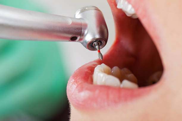 Best Emergency Tooth Extraction in Grand Blanc, MI